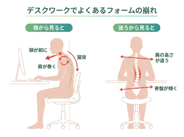 フォーム不全（身体の使い方の崩れ）の解説図