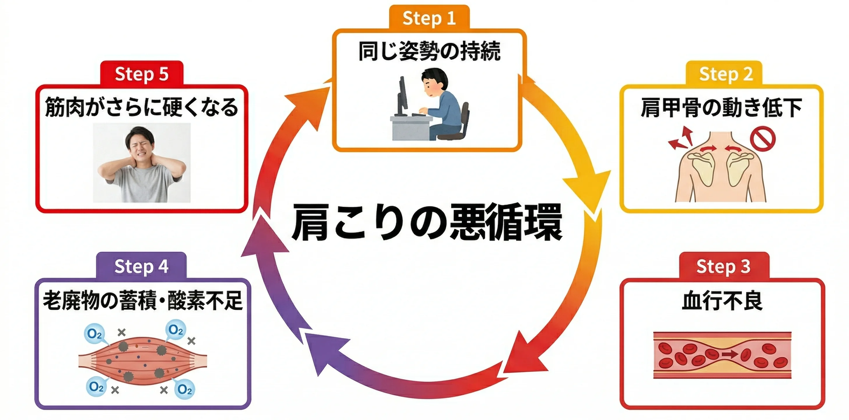 肩こり発生メカニズムの悪循環フロー図解