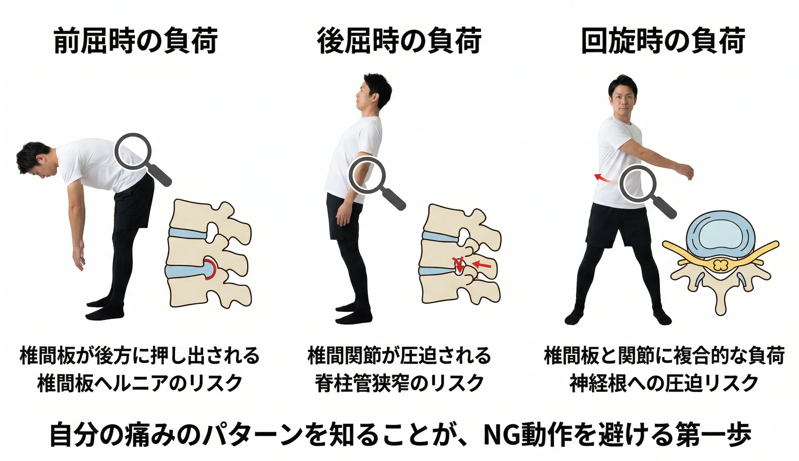 前屈・後屈・回旋時の腰痛メカニズムの解剖図