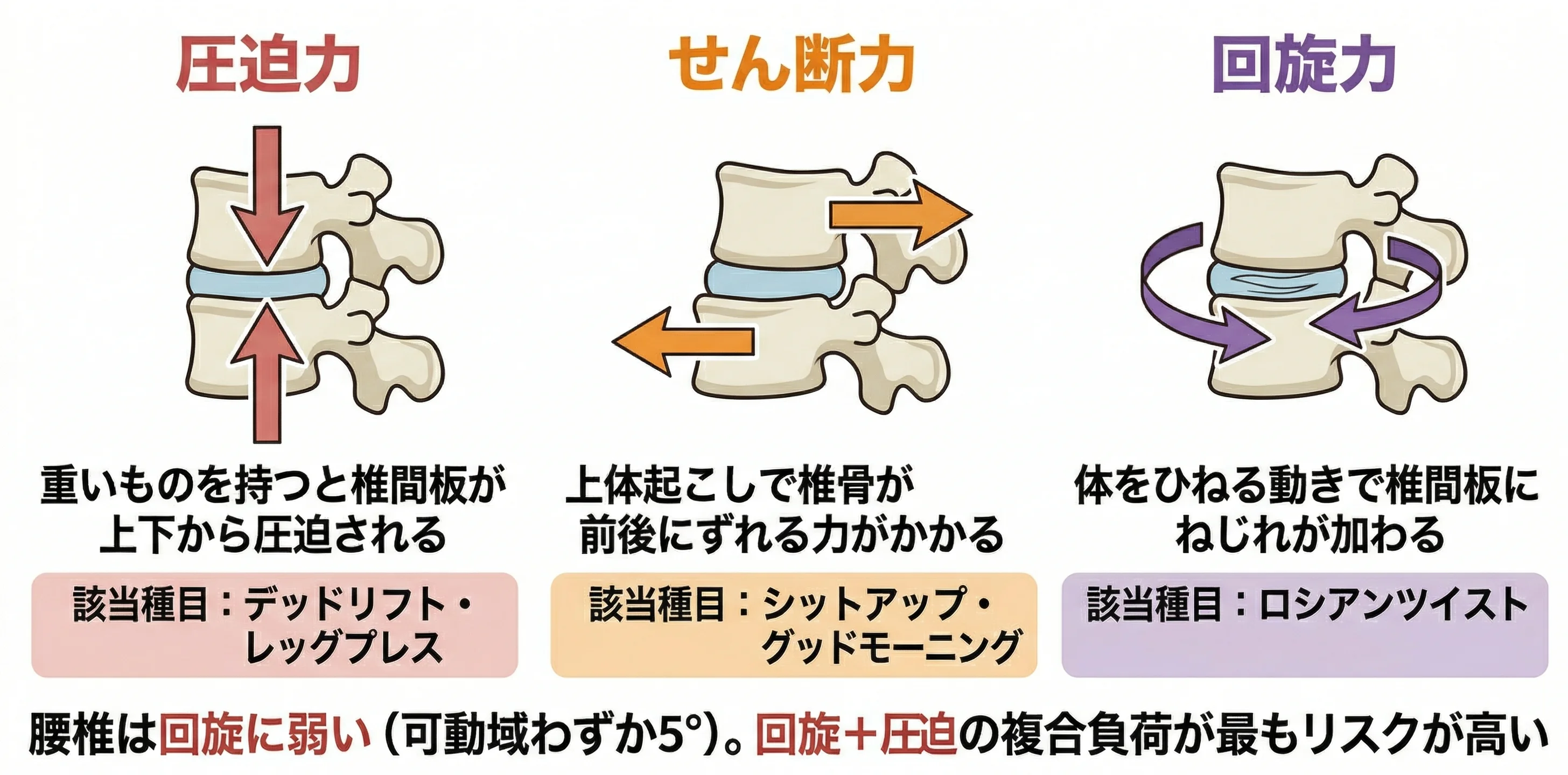 腰椎への3つの力学的負荷（圧迫・せん断・回旋）の解説図