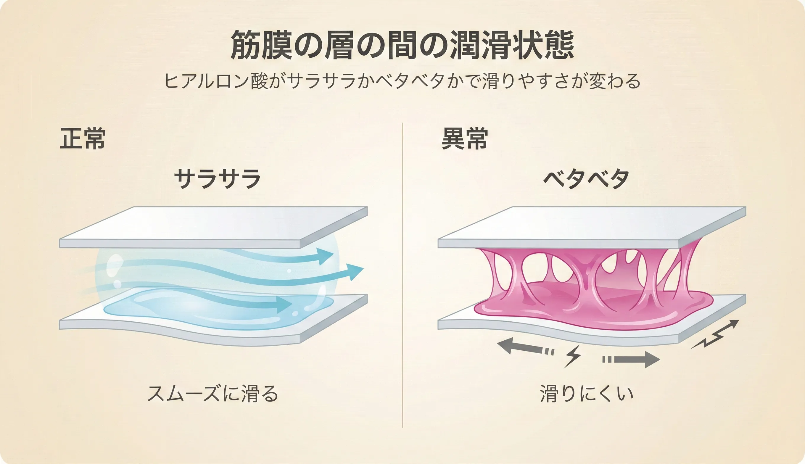 筋膜の滑走改善