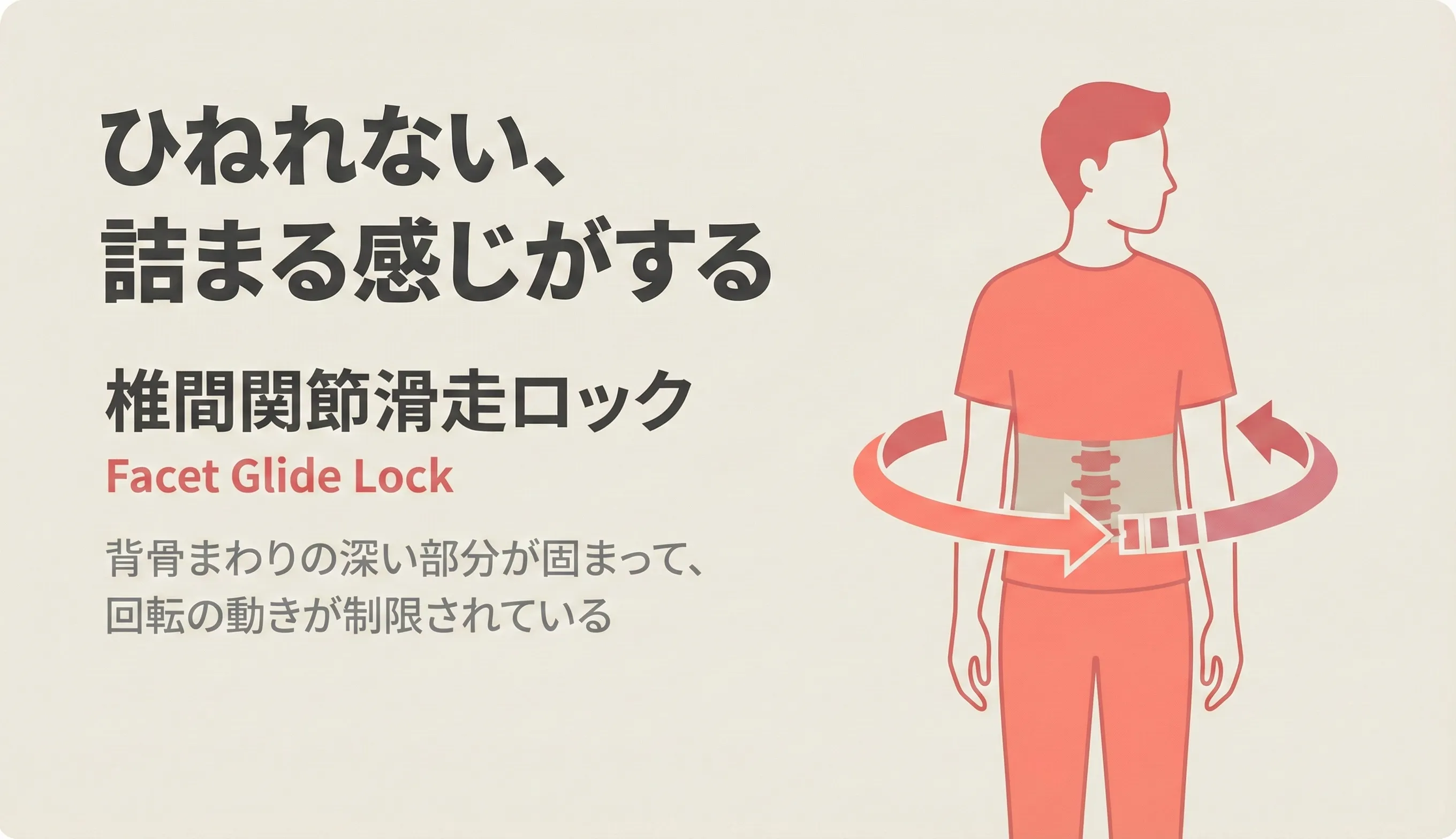 Facet Glide Lock（椎間関節滑走ロック）のイメージ：脊椎周囲の深層筋膜の滑走が悪化し、ひねれない・詰まる状態の図解