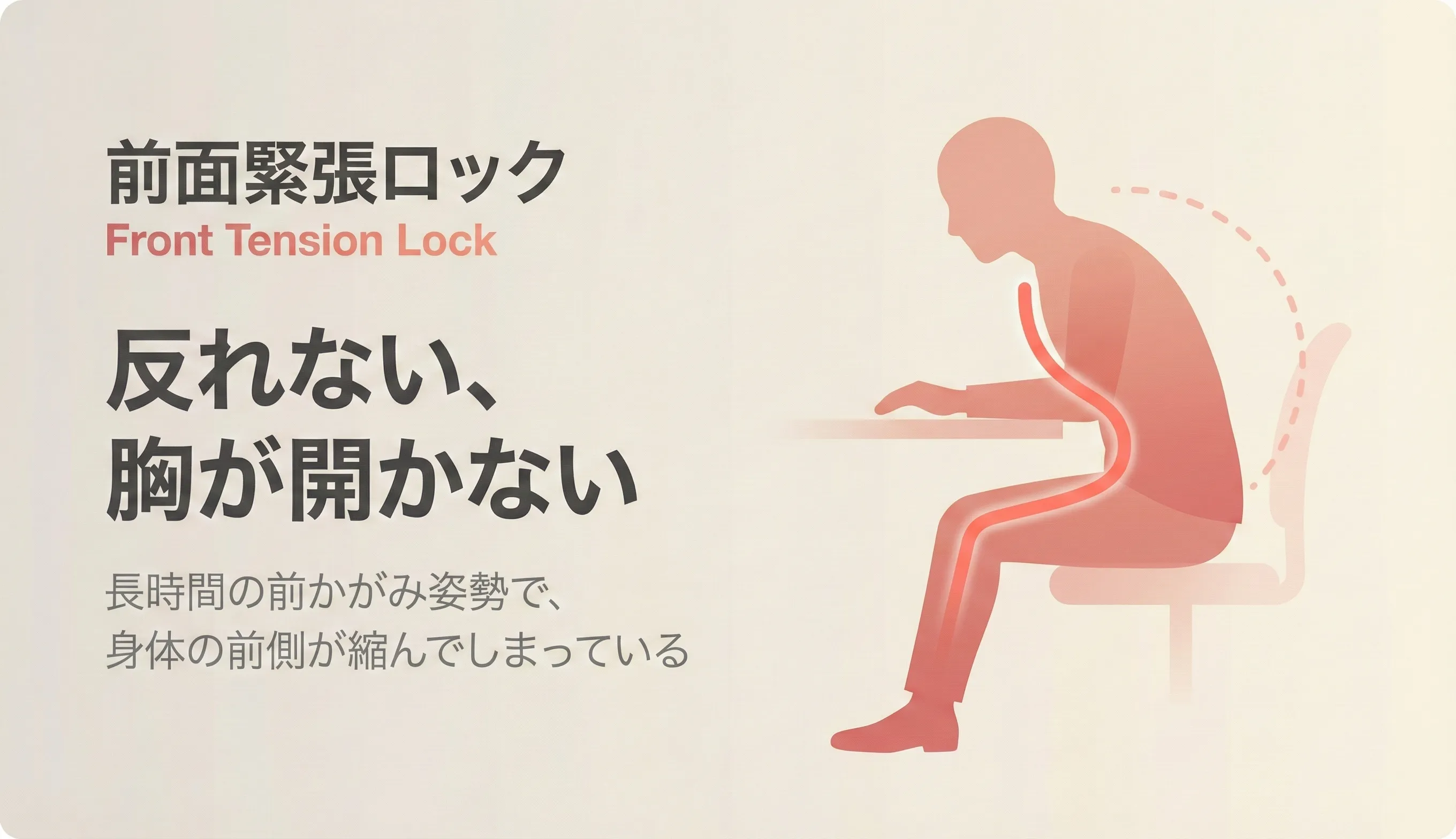 Front Tension Lock（前面緊張ロック）のイメージ：前面の筋膜ラインが短縮し、反れない・胸が開かない状態の図解
