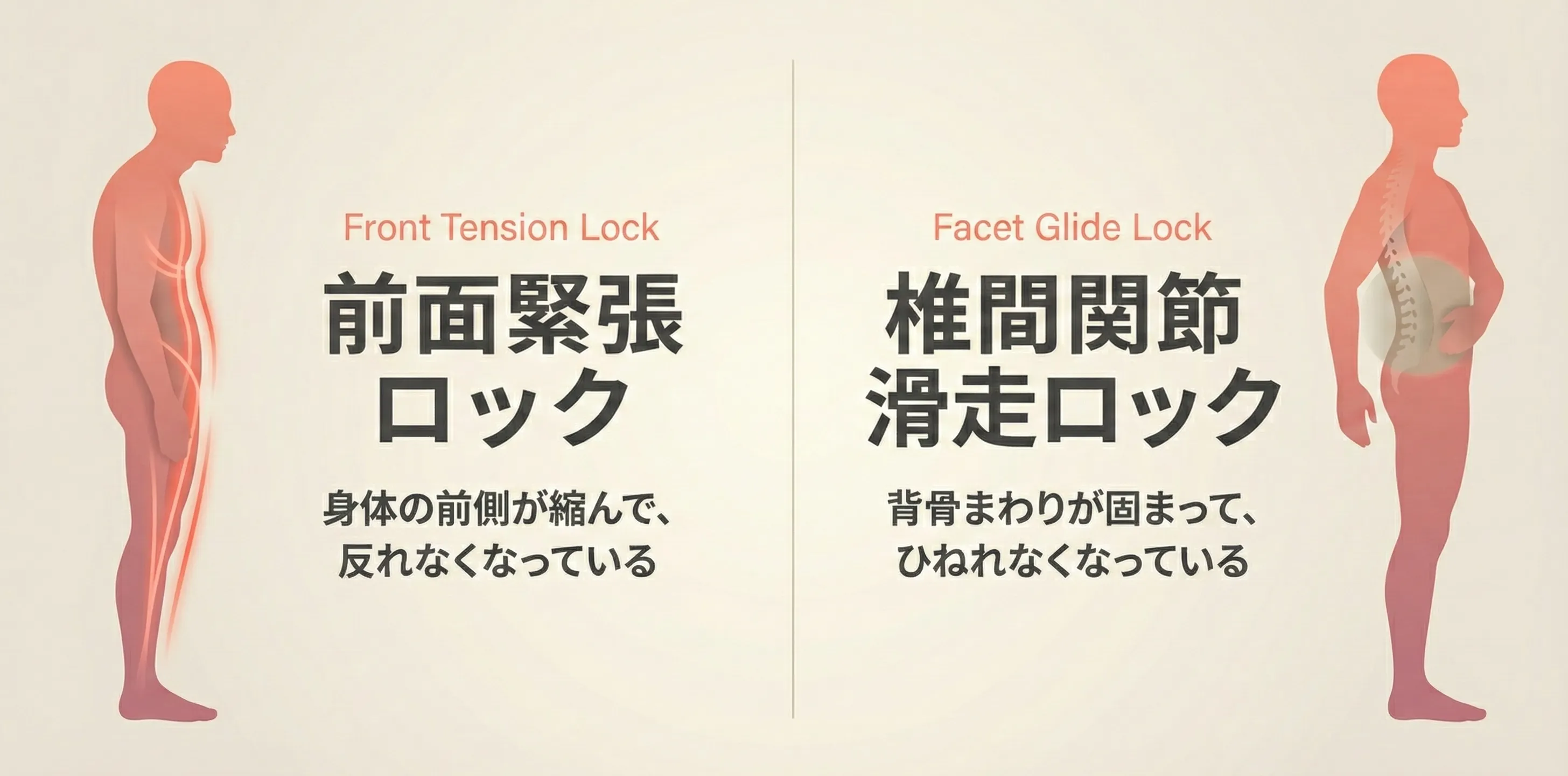 Front Tension Lock（前面緊張ロック：反れない・伸びない）とFacet Glide Lock（椎間関節滑走ロック：ひねれない・詰まる）の2つの原因を示す概念図