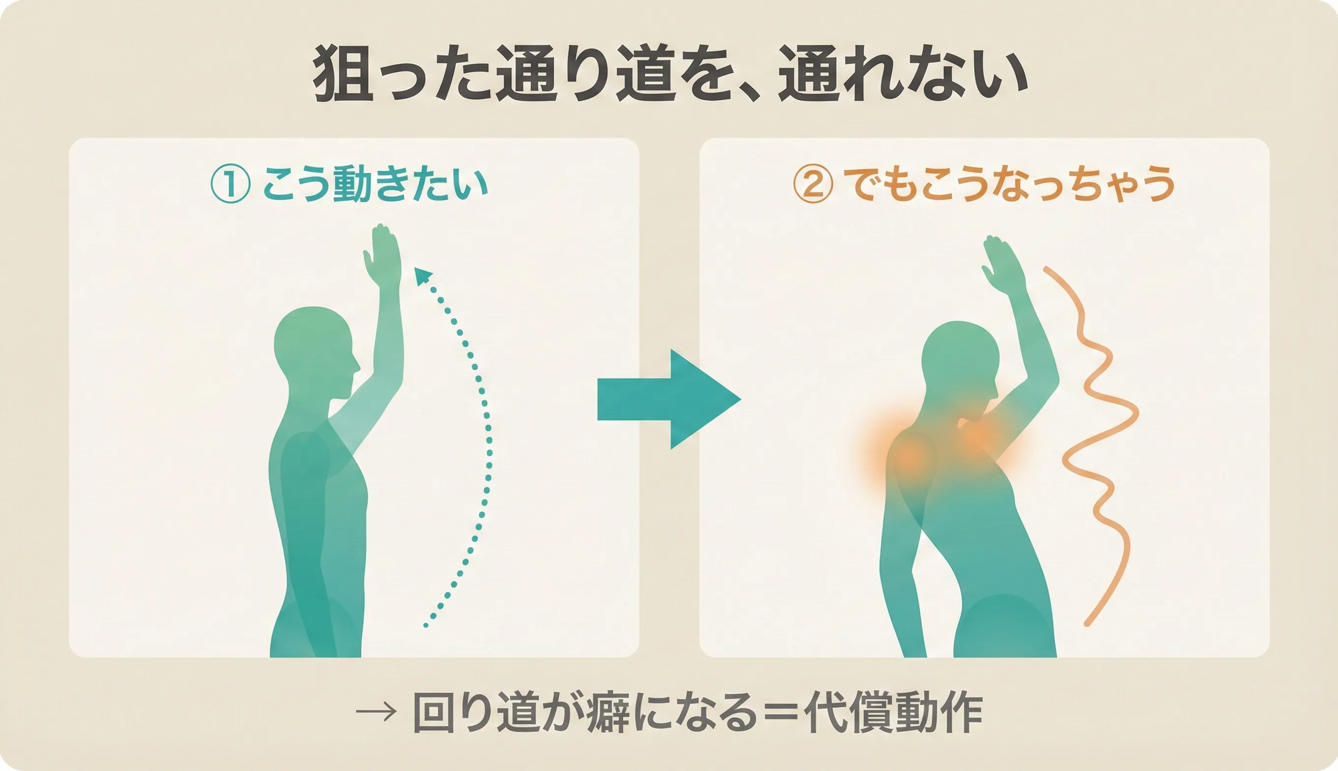 Trajectory Lock（軌道ロック）のイメージ：動作中に狙った通り道を通れず、代償動作が無意識に固定されてしまう状態の図解