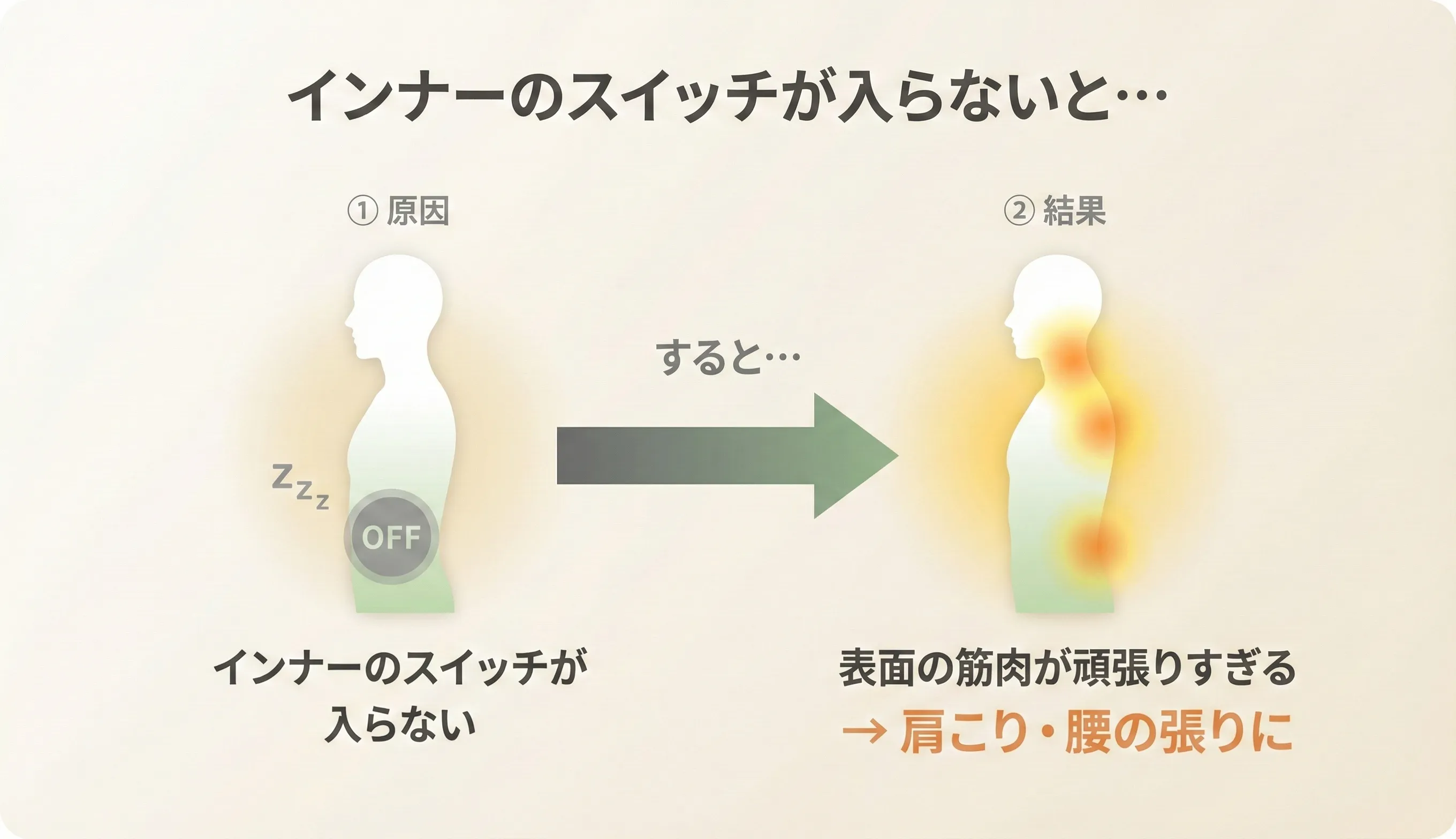 Timing Lock（タイミングロック）のイメージ：インナーが入るべき時に入らず、表面の筋肉が先に過活動を起こしている状態の図解