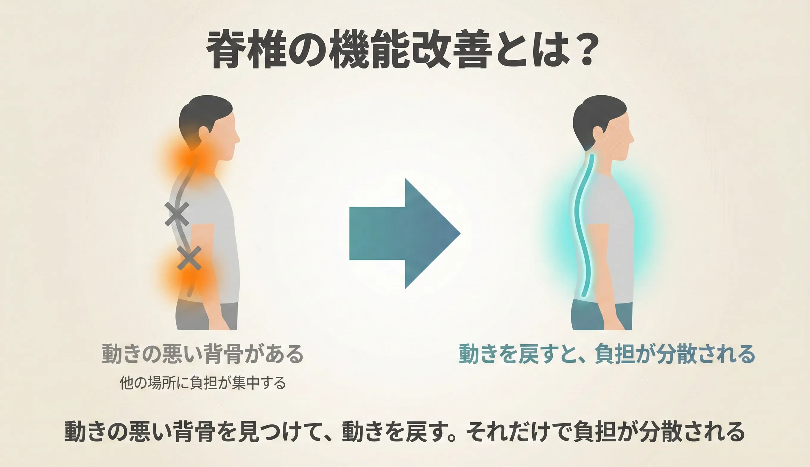 運動の配分を再構築するイメージ：正常な脊椎では各椎間が適切に動き、機能障害がある脊椎では特定部位に負荷が集中している図解
