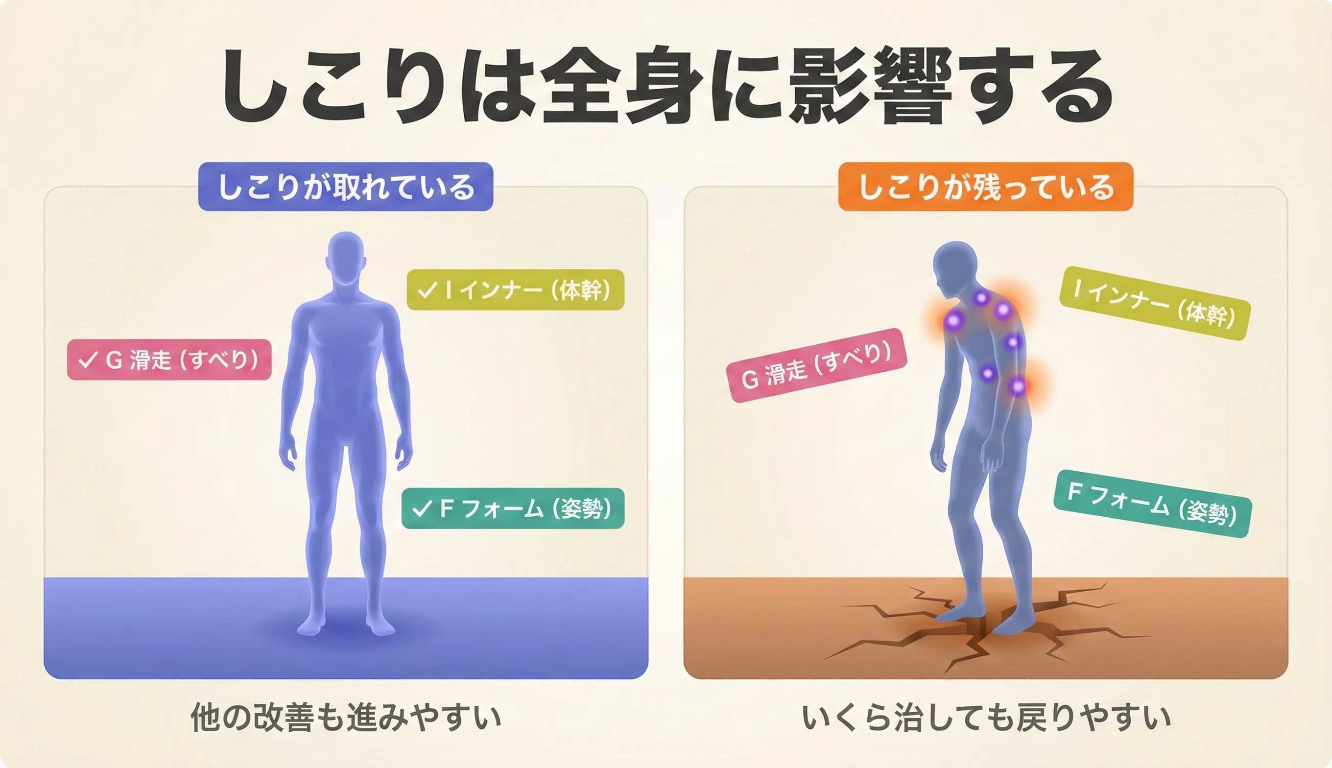 トリガーポイントの改善がフォーム（F）→滑走（G）→インナー（I）へ波及する連鎖の図解