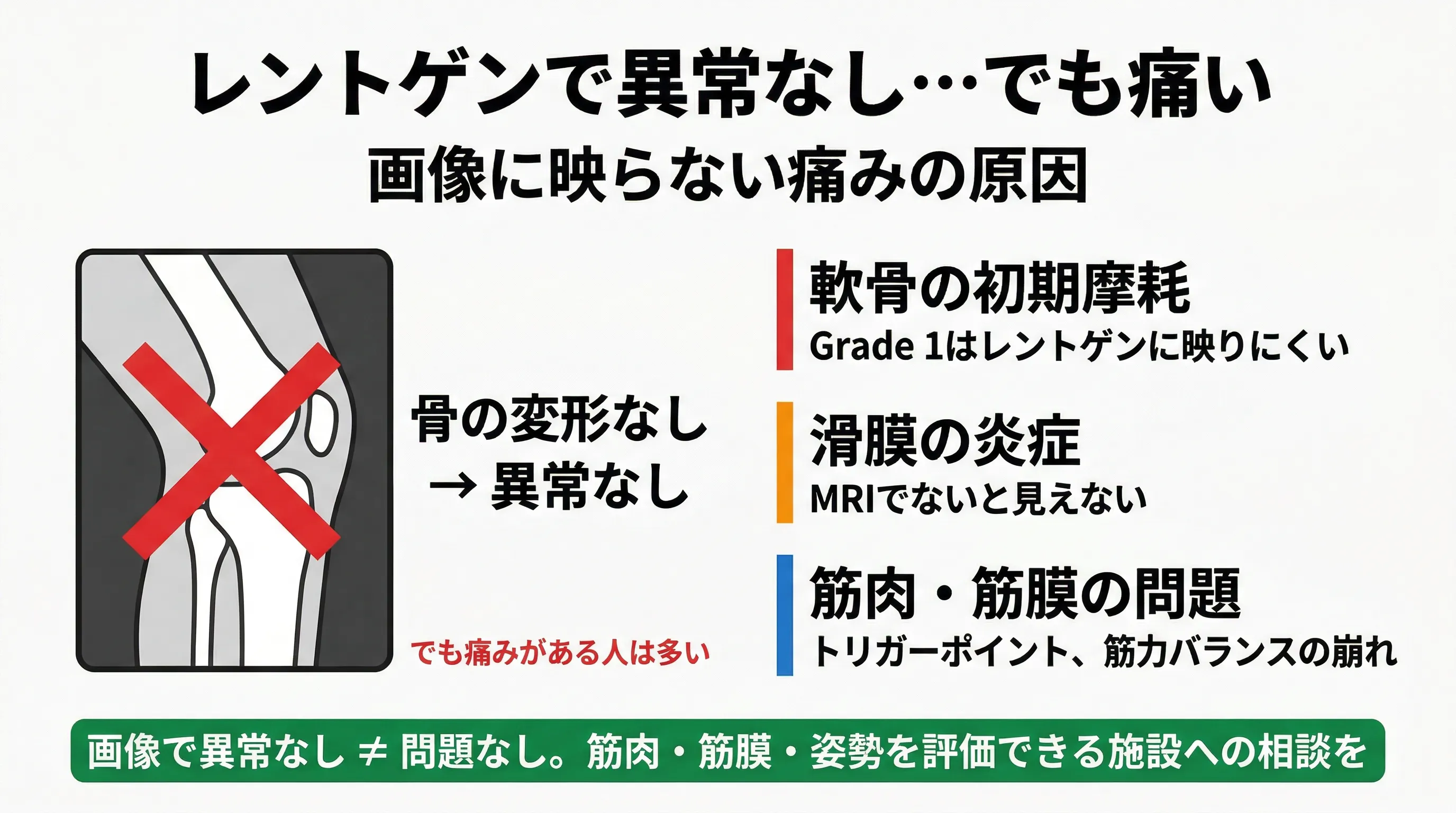 手術の前にできること KLグレード4でも無症候の割合