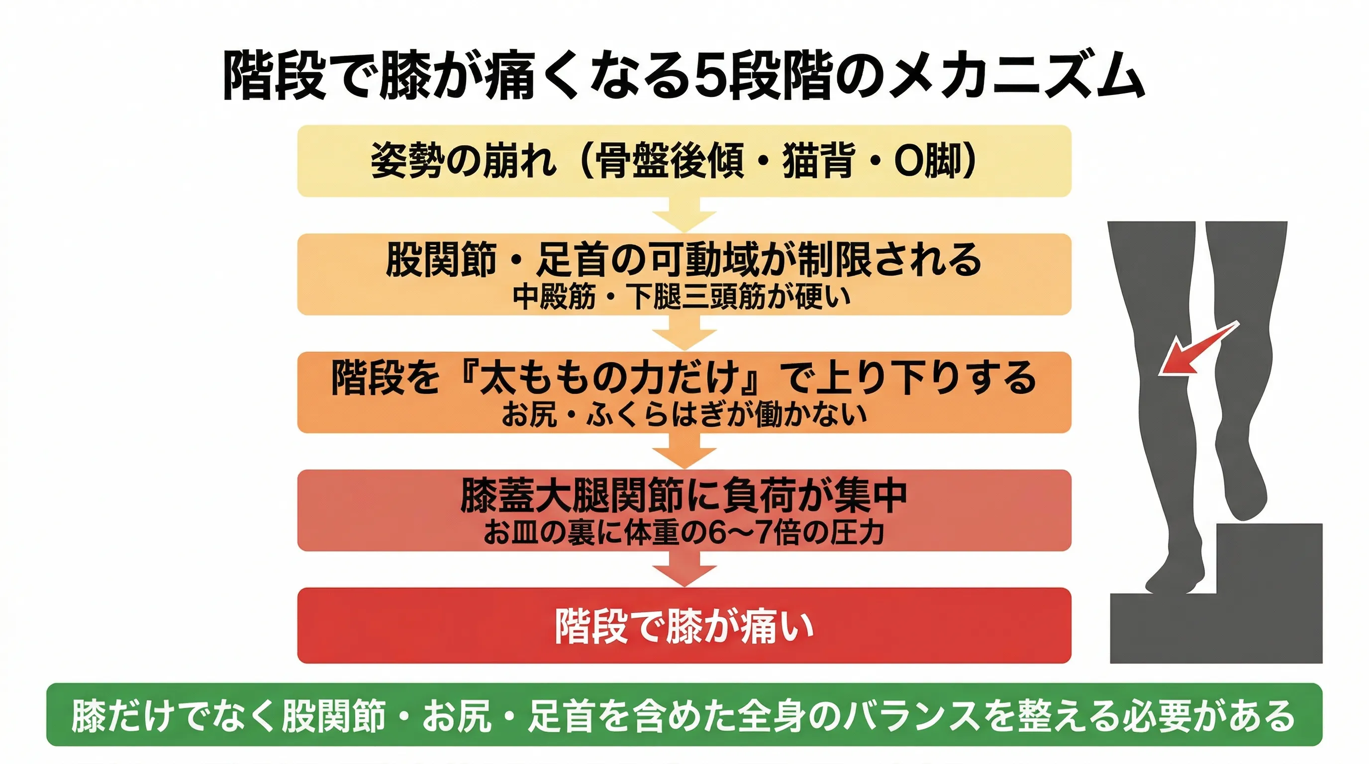 姿勢の崩れから階段で膝が痛いメカニズム