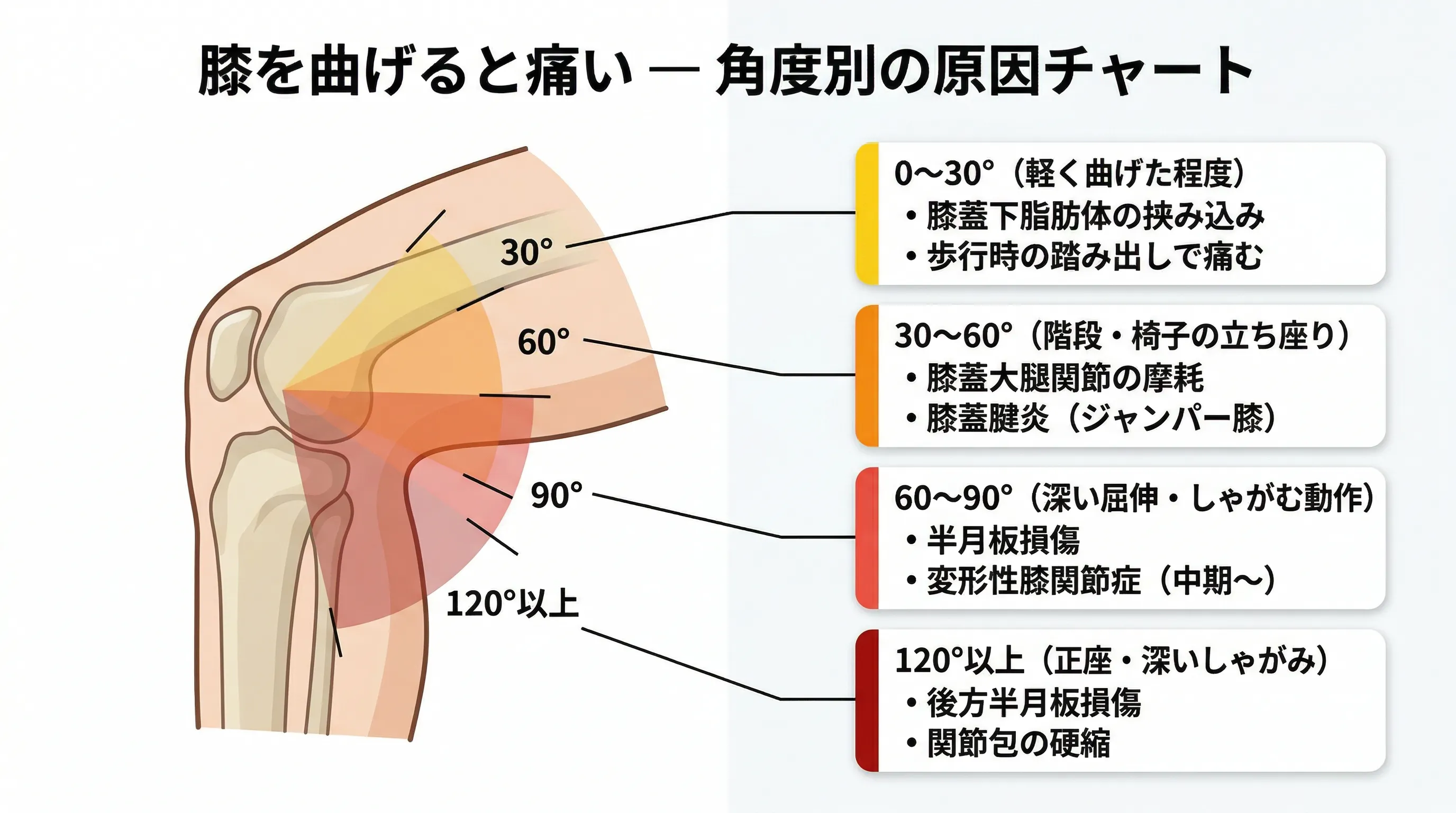 膝を曲げると痛い 角度別の原因チャート