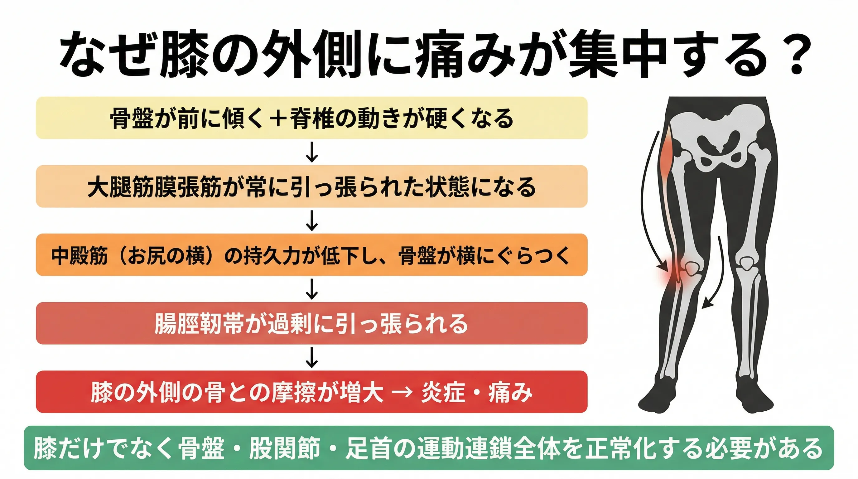 膝の外側に負荷が集中する5段階メカニズム