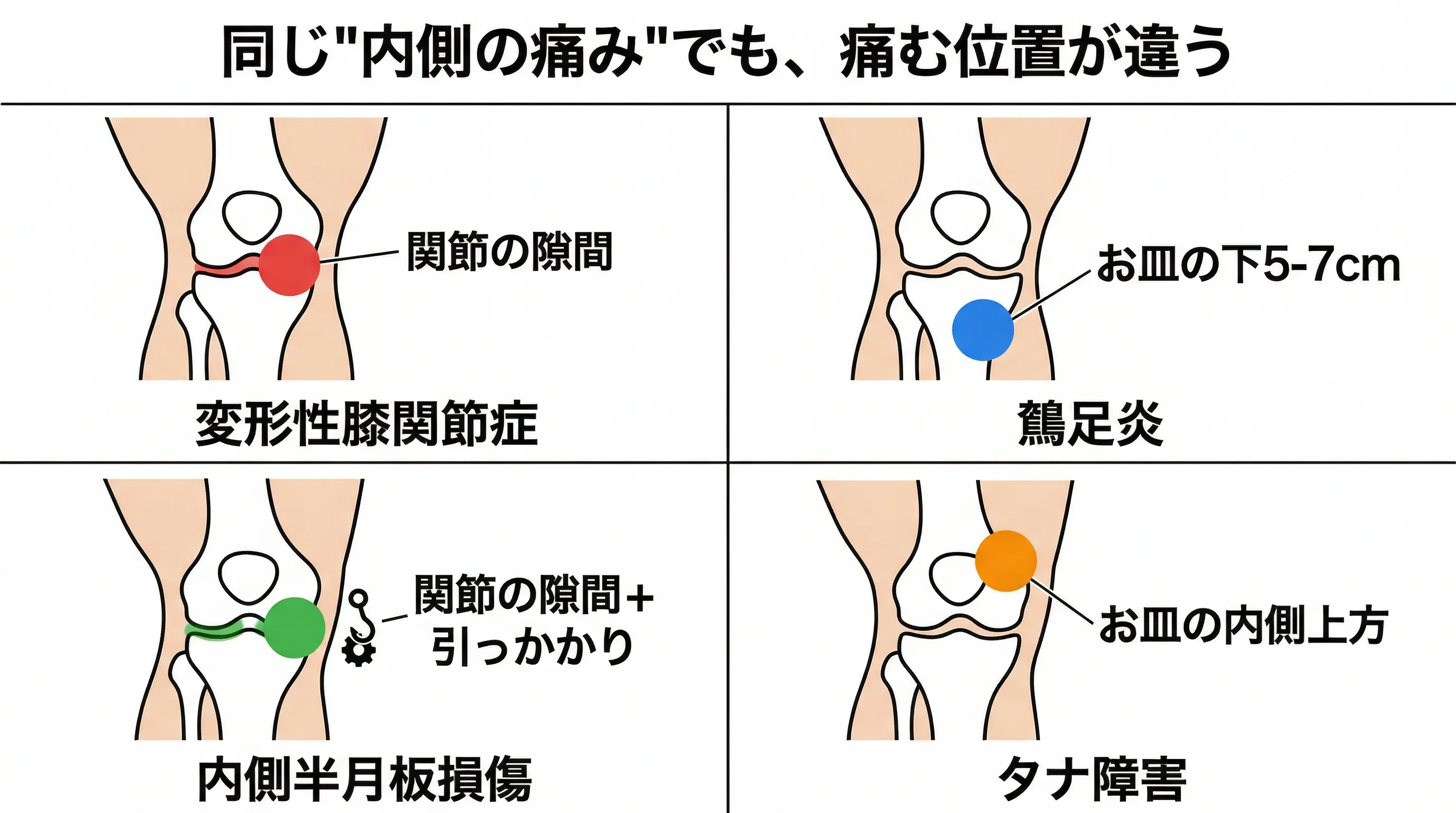 4疾患の痛む位置比較