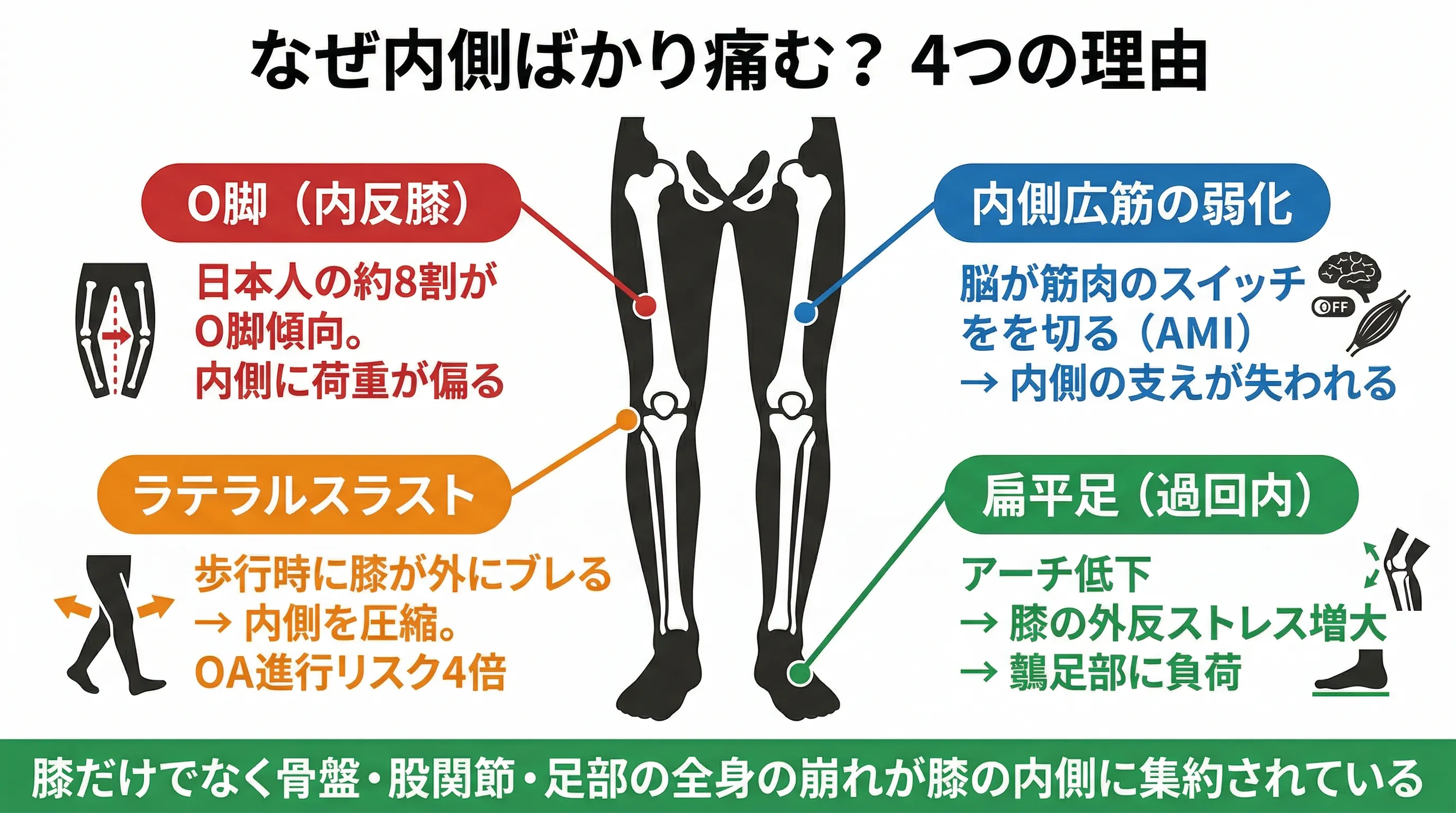 内側に負荷が集中する4つの理由