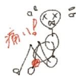 受傷後48時間