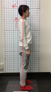 猫背矯正アフター2