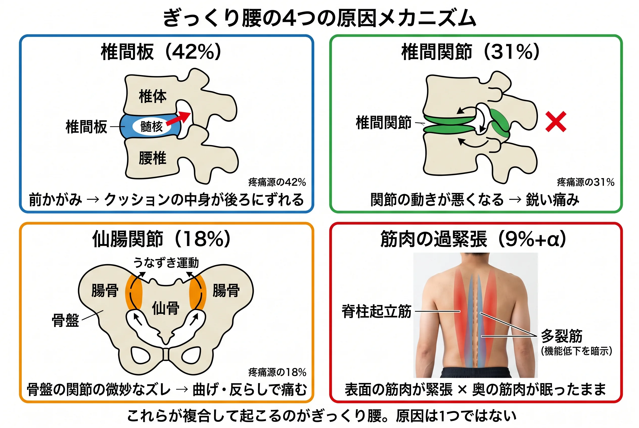 腰椎の4つの疼痛源メカニズム図：椎間板42%・椎間関節31%・仙腸関節18%・筋肉の過緊張