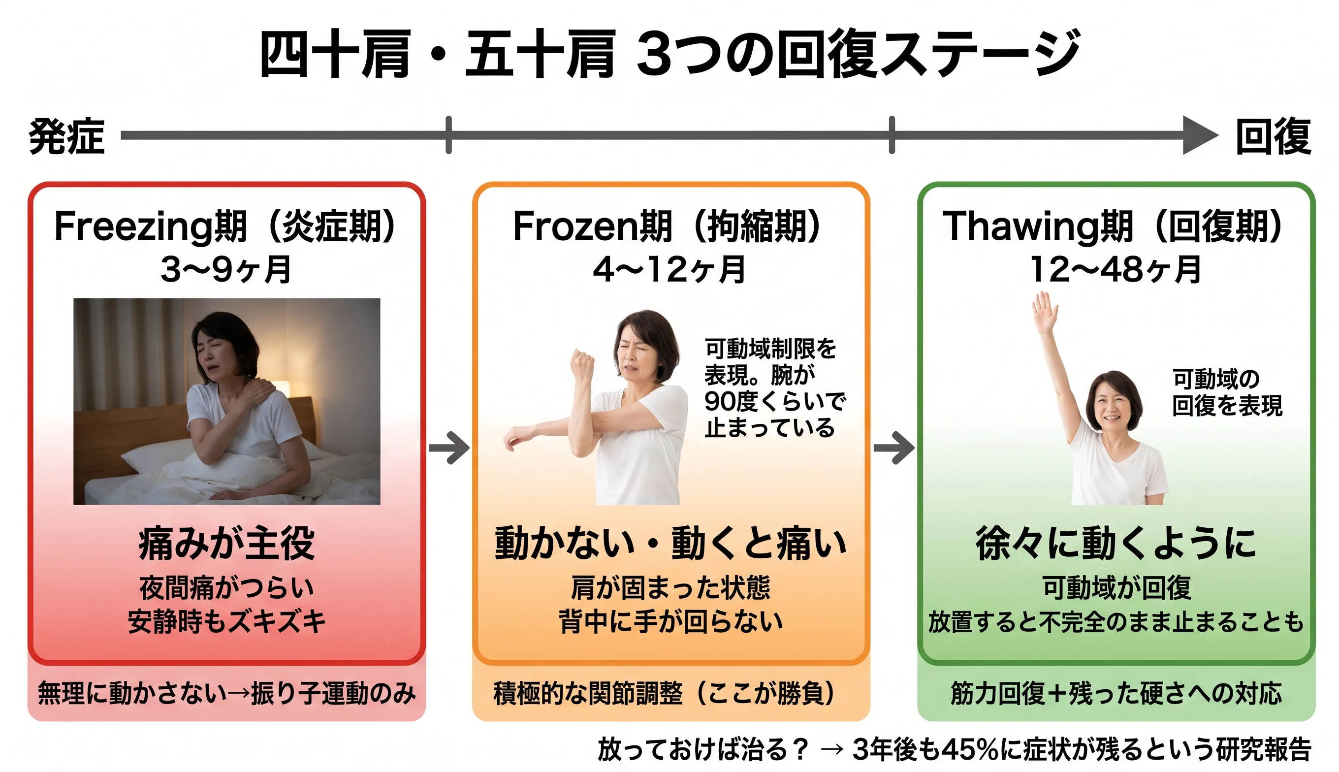 四十肩・五十肩 3つの回復ステージタイムライン：Freezing期(炎症期)→Frozen期(拘縮期)→Thawing期(回復期)