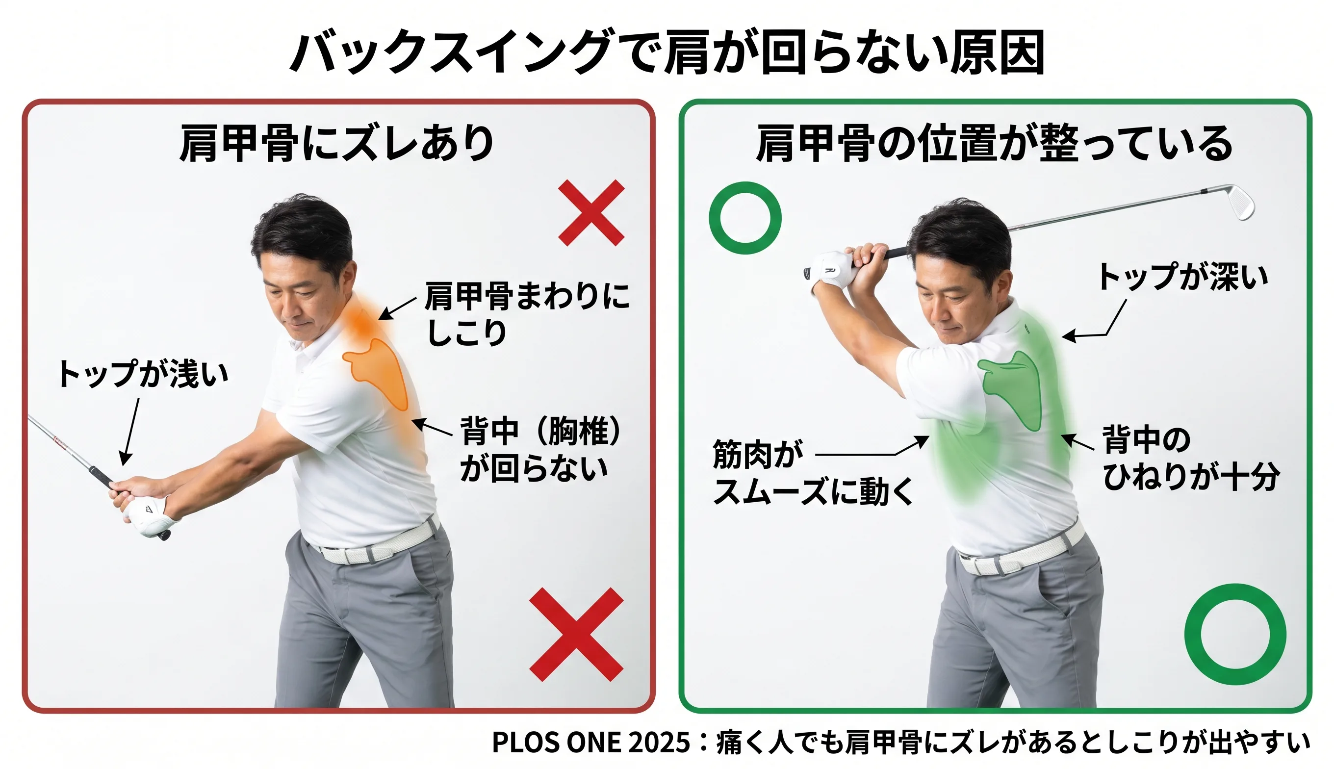 バックスイングで肩が回らない原因：肩甲骨にズレありでトップが浅い vs 肩甲骨が整ってトップが深い比較図