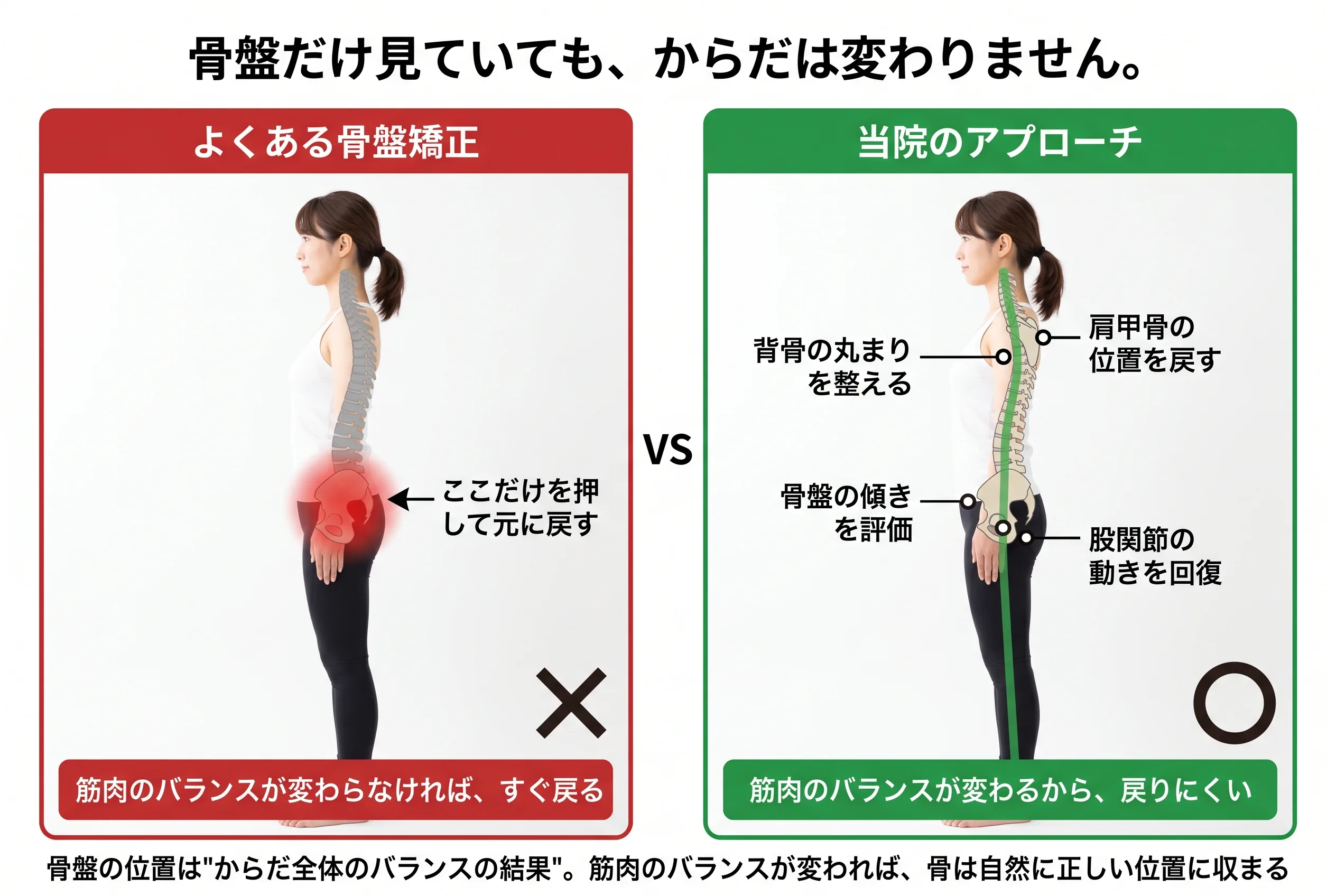 骨盤だけのアプローチvsからだ全体のアプローチ比較図：背骨〜肩甲骨〜骨盤〜股関節を整える当院の方針