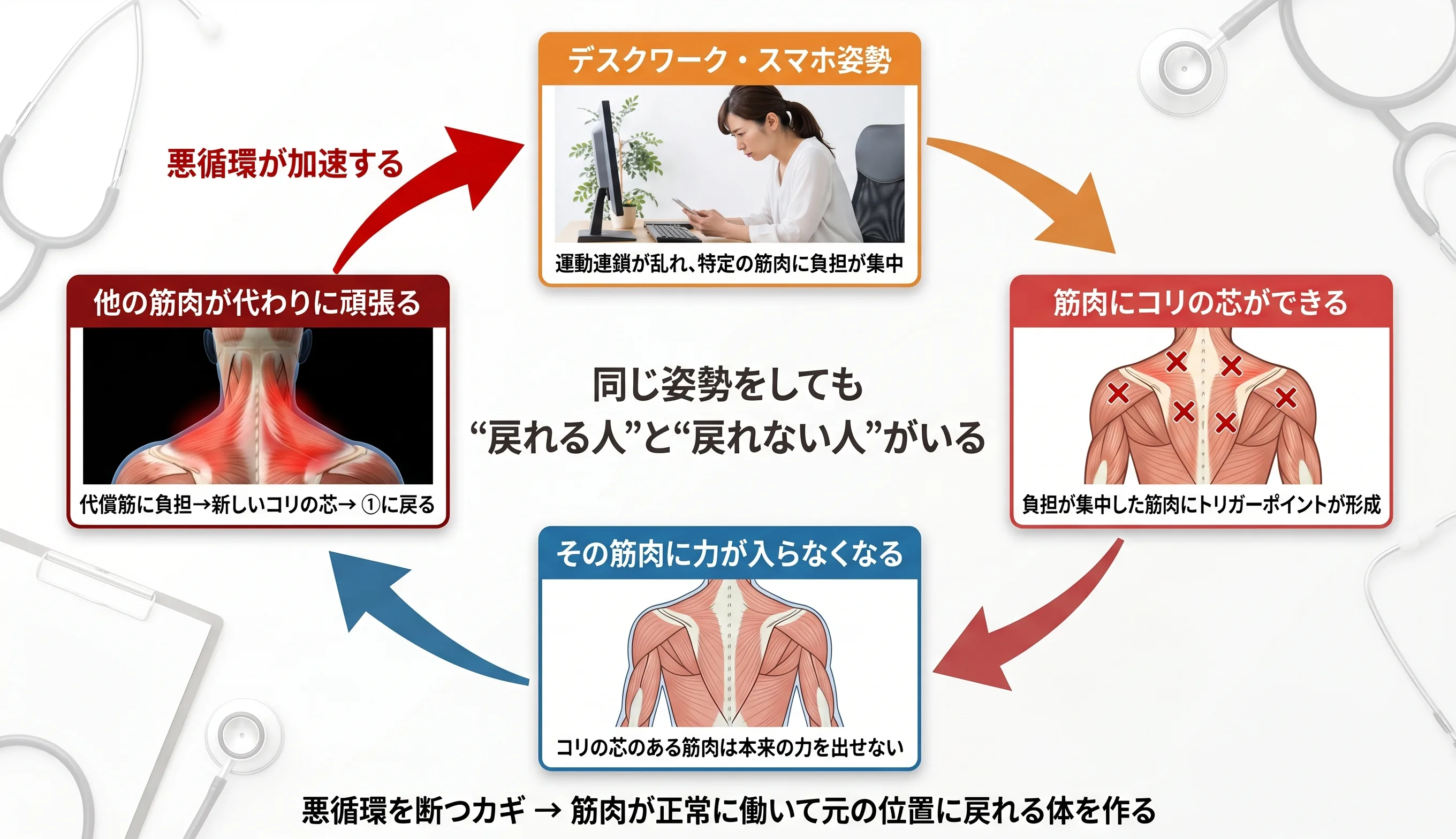 戻れない体の悪循環メカニズム図：デスクワーク姿勢→コリの芯→筋力低下→代償筋が頑張る→さらに姿勢が崩れる