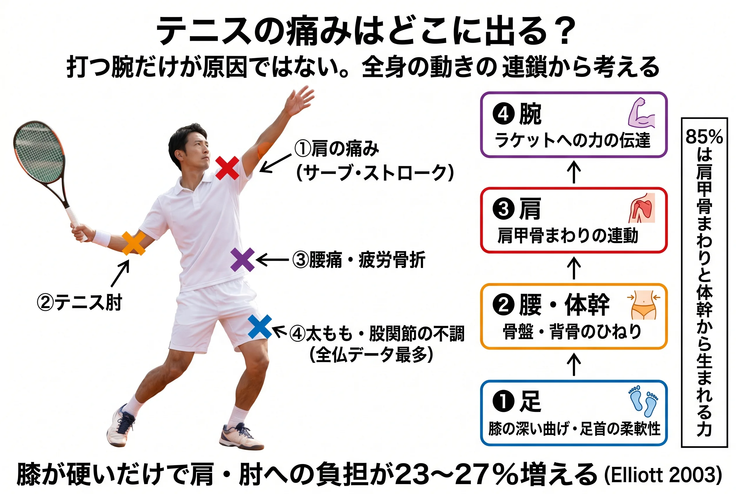 テニスの痛み部位マップ：肩・肘・腰・太もも・股関節の4部位と足→腰→肩→腕の動きの連鎖
