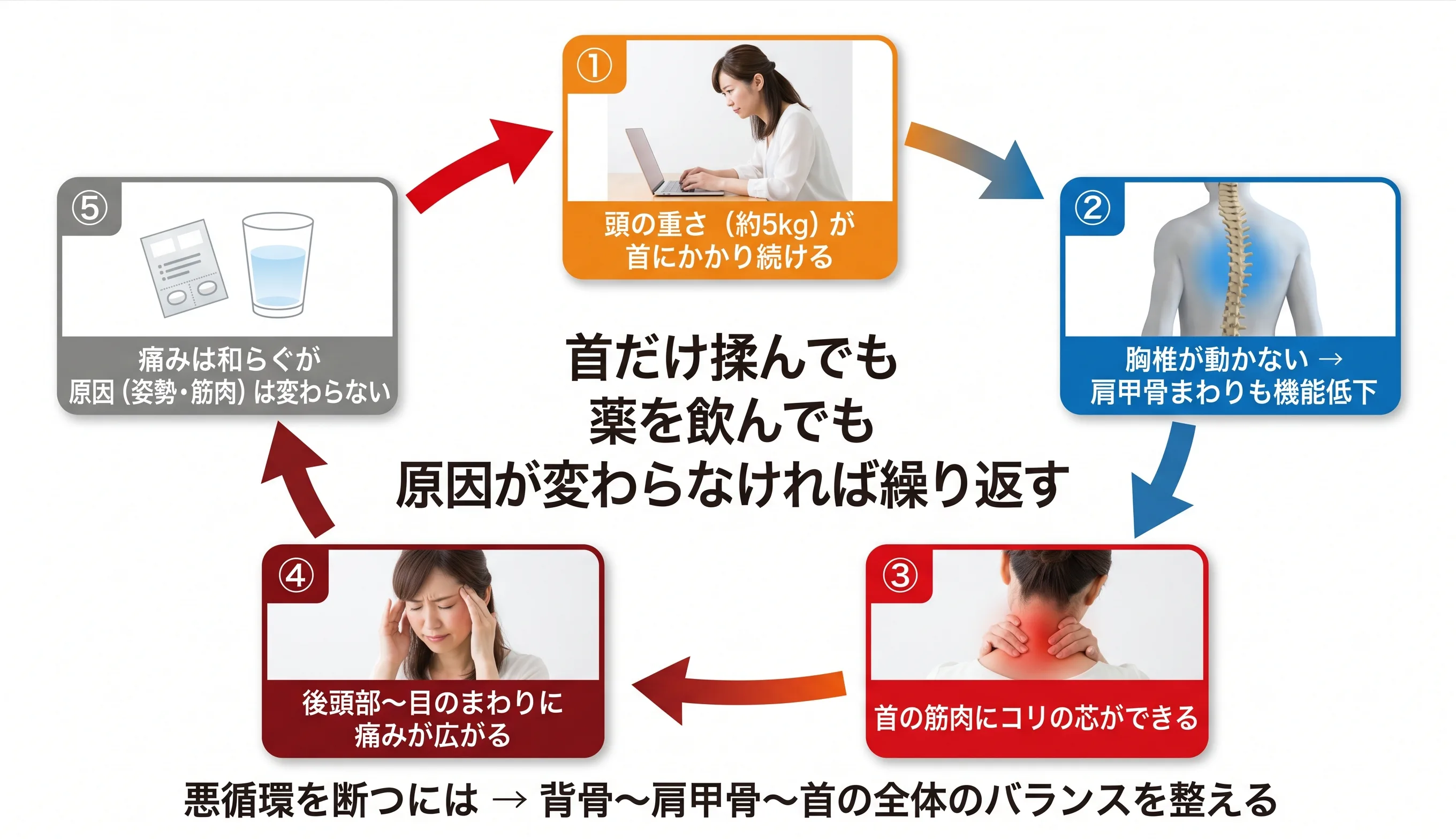頭痛の悪循環サイクル図：前かがみ姿勢→背骨の動き低下→首の筋肉が頑張りすぎる→頭痛→頭痛薬で一時しのぎ