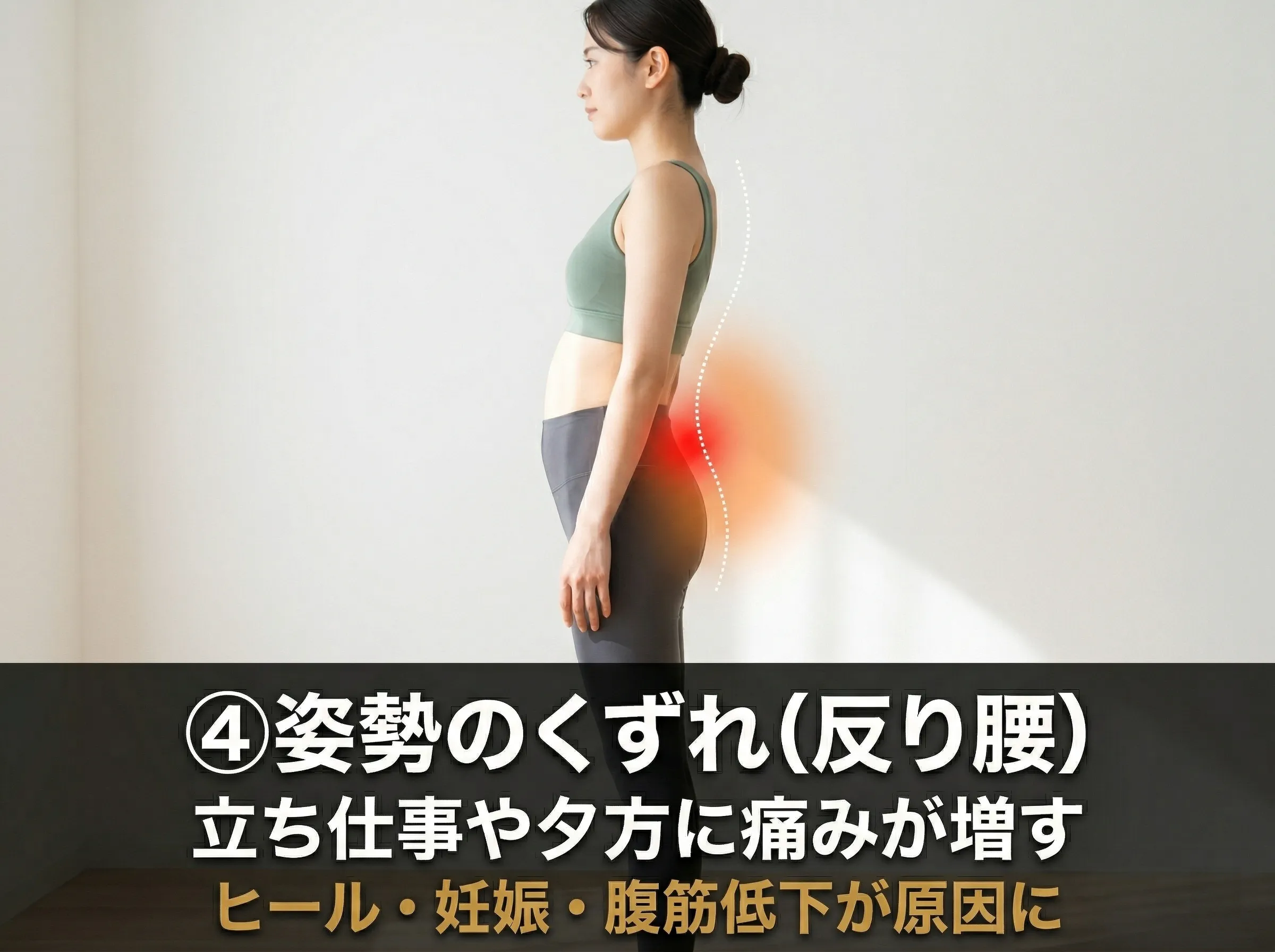 姿勢・アライメント由来の腰痛 — 反り腰・骨盤の歪み