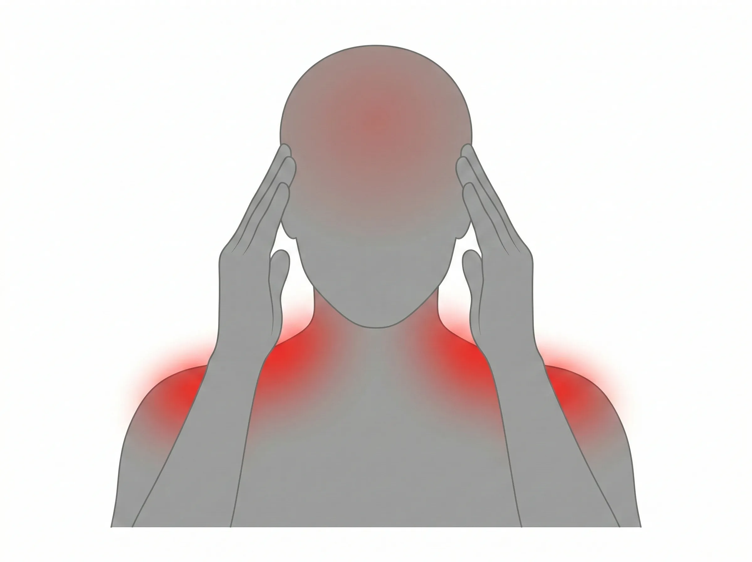 両手でこめかみを押さえる人のシルエット。肩から首と頭全体が赤く光り、緊張型頭痛を表現