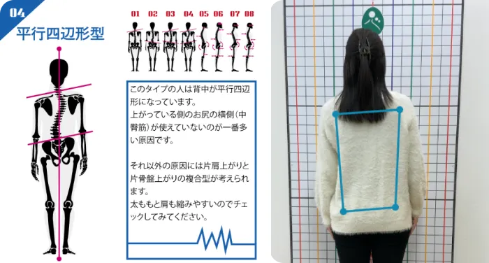 AI姿勢分析で姿勢のタイプを判定した結果と、格子の前で姿勢を撮影した写真