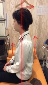 掲載事例3:施術後の姿勢