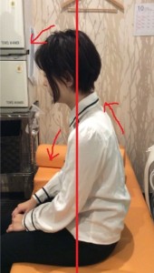 掲載事例3:施術前の姿勢
