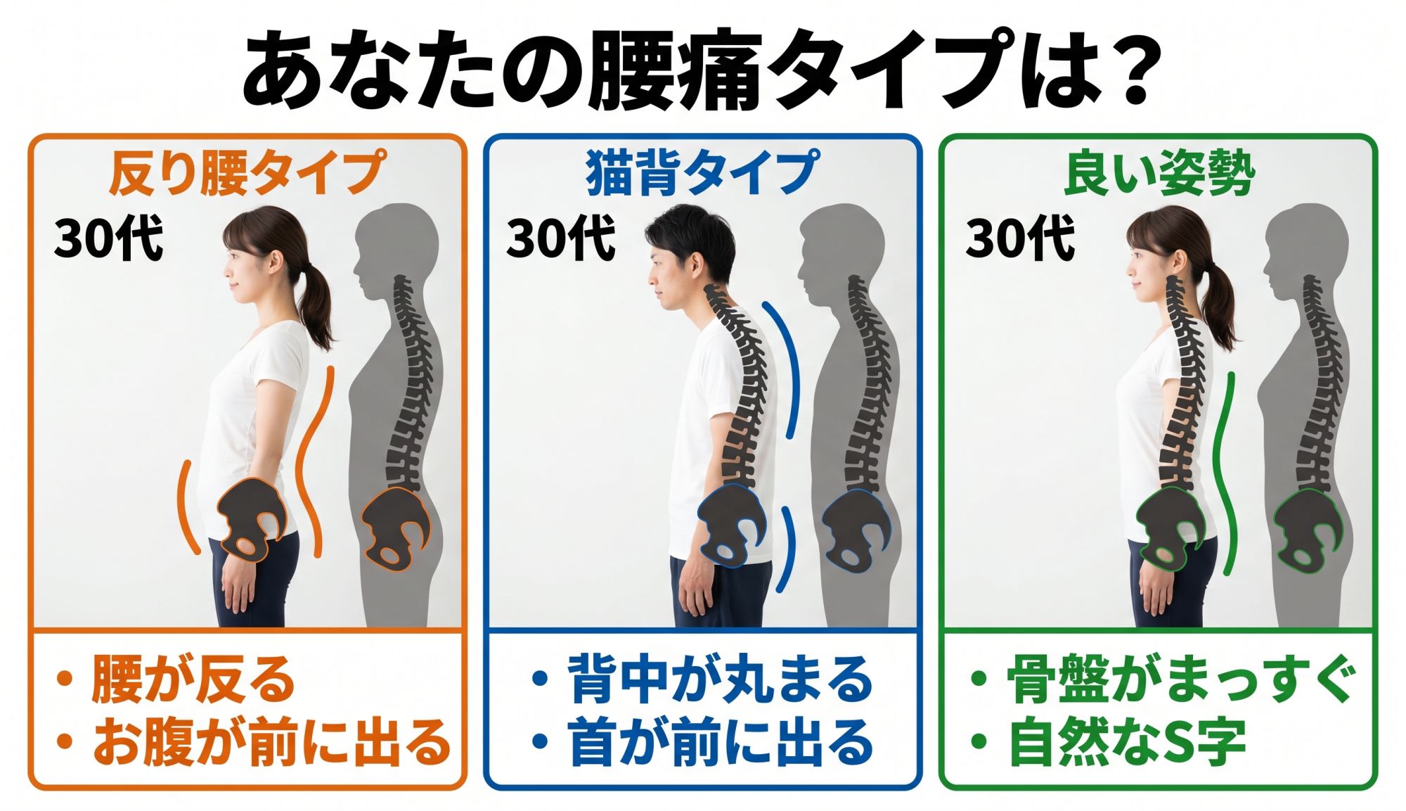 あなたの腰痛タイプは？