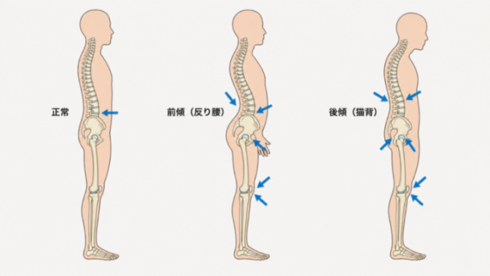 コンテンツ画像