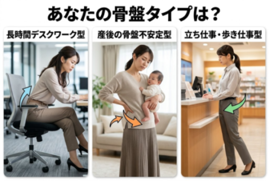 骨盤の歪み3タイプを並べた比較図