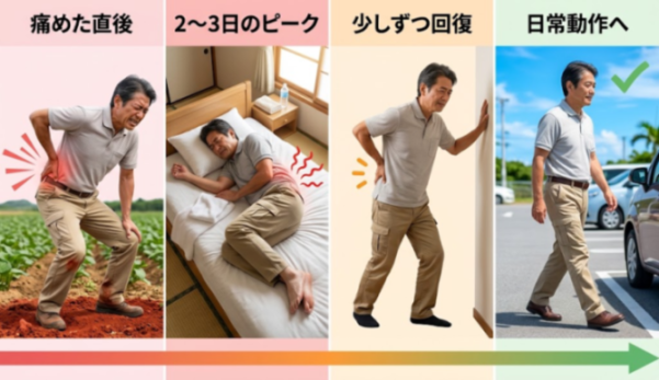 ぎっくり腰の経過の目安を示した図