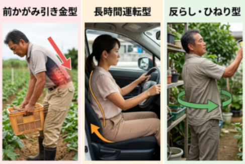 ぎっくり腰のタイプ別の特徴を比較した図