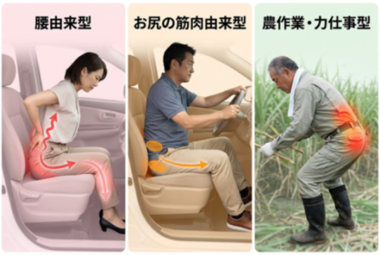 坐骨神経痛のタイプ別の比較図