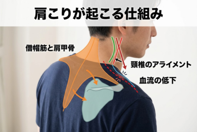 僧帽筋と肩甲骨と頸椎の関係の解説図