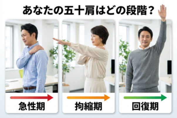 五十肩の3段階（急性期・拘縮期・回復期）比較図