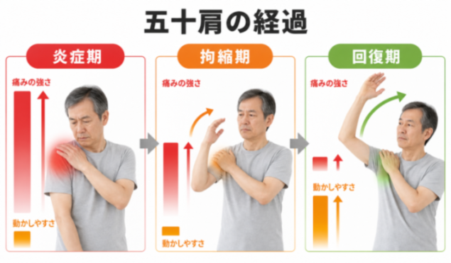 コンテンツ画像