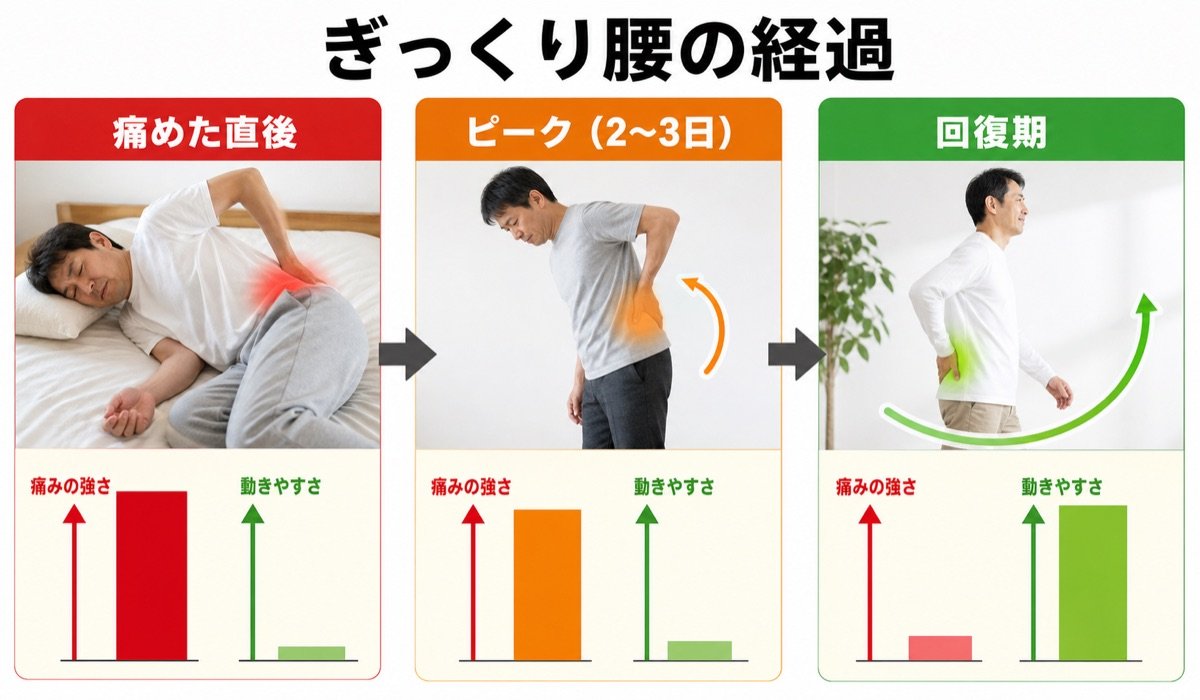ぎっくり腰の経過