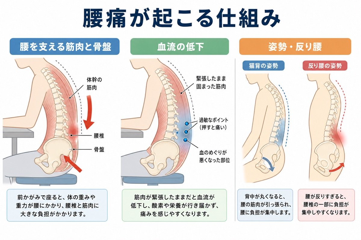 腰痛メカニズム図解