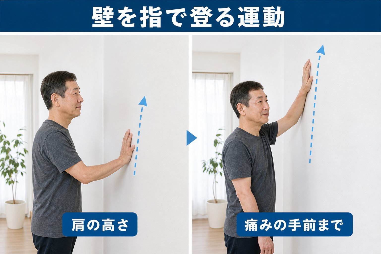 五十肩の改善方法｜中区・上前津で肩の動かしにくさをやわらげる対処と