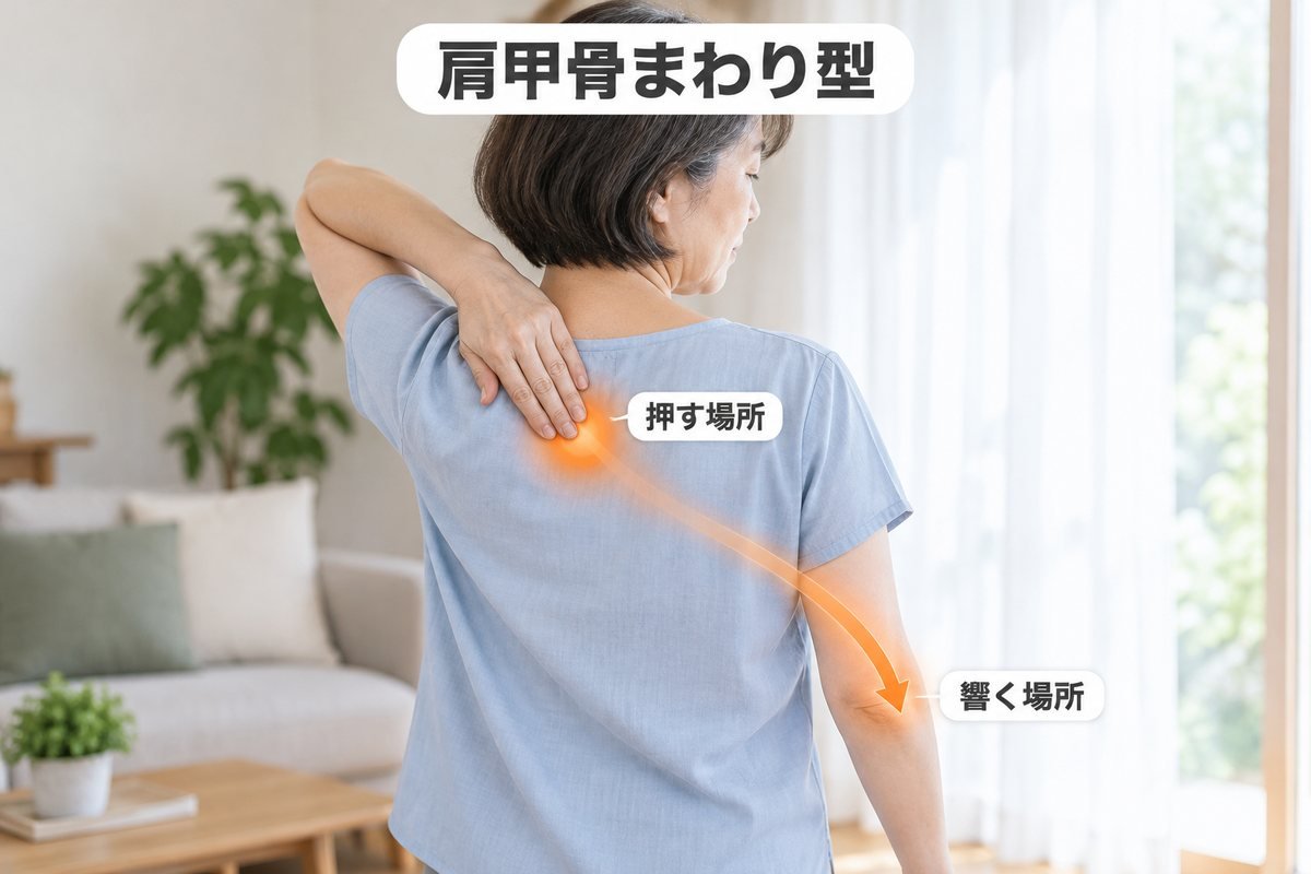 タイプ③肩甲骨まわり型
