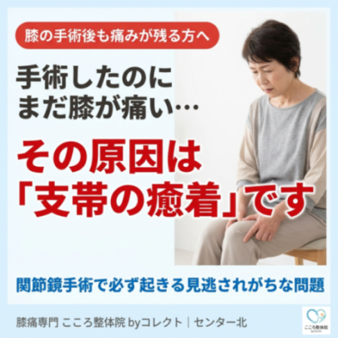 【横浜市都筑区】関節鏡手術後も膝が痛い原因は「膝蓋支帯の癒着」？お皿の動きとの関係を解説