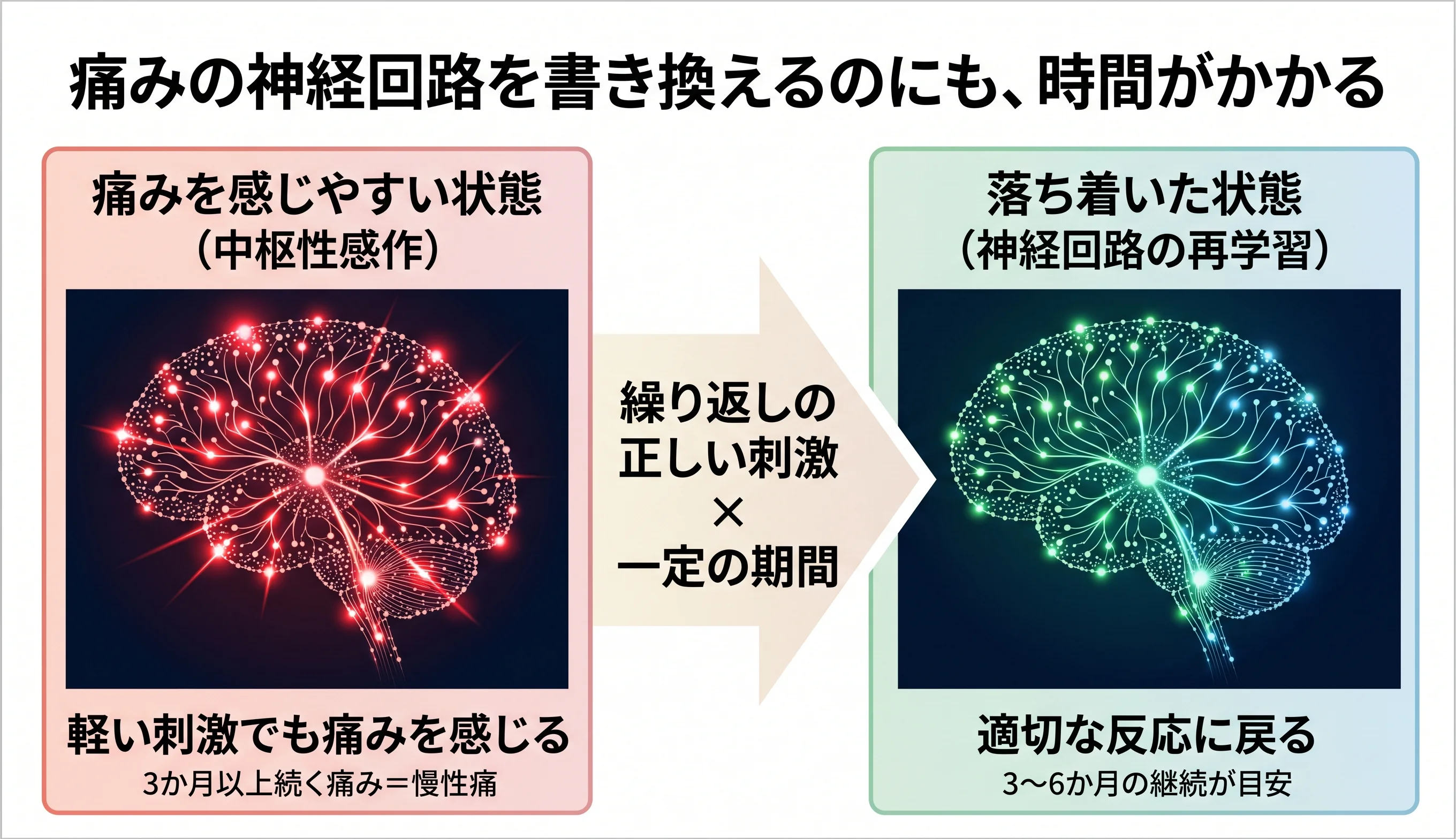 痛みの神経回路を書き換えるのにも、時間がかかる：繰り返しの正しい刺激×一定の期間で、中枢性感作から神経回路の再学習へ